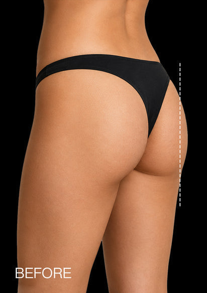 Sagging — before